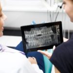 Invisalign treatment procedure- 3d smile scan