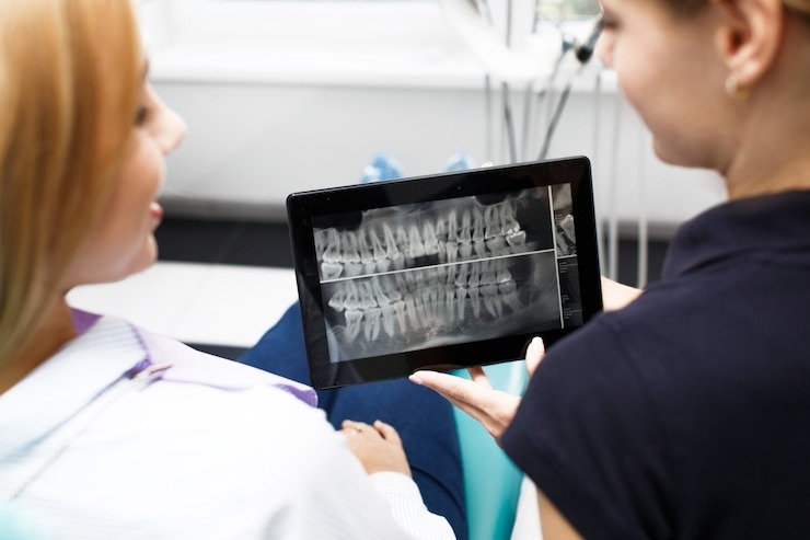 Invisalign treatment procedure- 3d smile scan