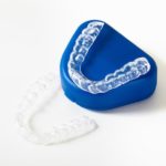 Invisalign treatment procedure- aligners